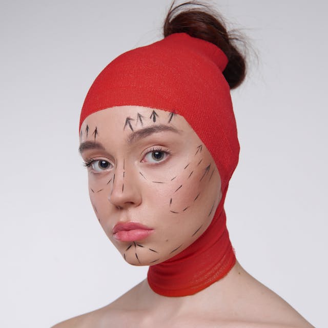 Plastic Surgery
